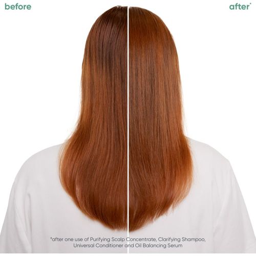 ScalpSync sérum capilar para cabello graso 50 ml - Biolage - Modalova