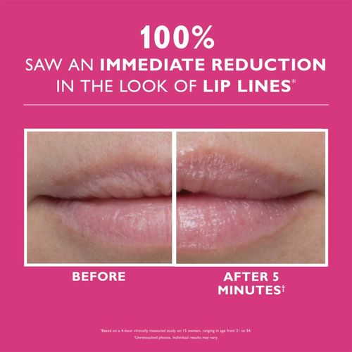 Instant FIRMx Lip Filler Sistema de relleno de labios 10 ml - Peter Thomas Roth - Modalova