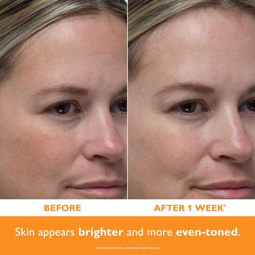 Potent-C™ Power Serum serum iluminador con vitamina C antienvejecimiento 30 ml - Peter Thomas Roth - Modalova