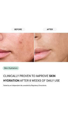 Shower Filter in - Qure Skincare - Modalova